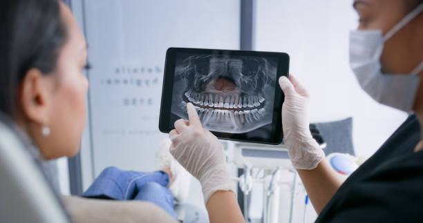 Licensed Tooth Extraction service in San Francisco, CA - Smile Center Dentistry